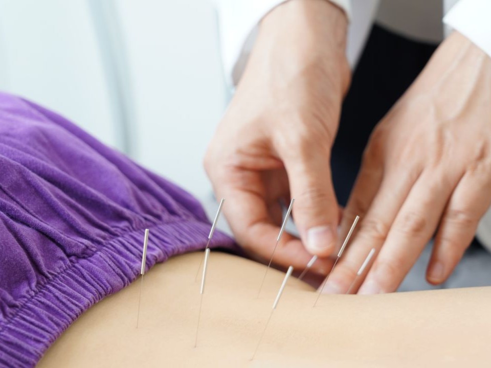 acupuncture treatments in Barnstaple Devon